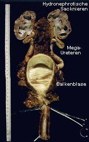 Urogenitalpräparat