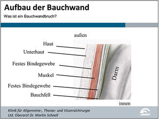 Abb. 1: Normaler Aufbau der Bauchwand in Schichten