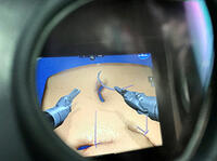 „Kamerasicht": Sicht auf Operationsfeld (3D/10-fach vergrößert. Virtuelles Trainingsprogramm zum Erlernen des Nähens)