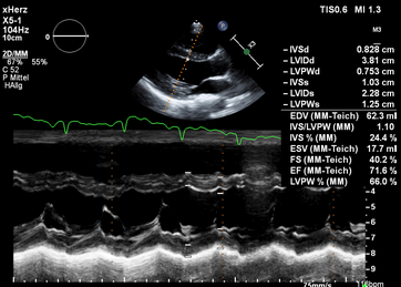 Parasternal lange Achse mit M-Mode Darstellung zur Vermessung der Herzwände